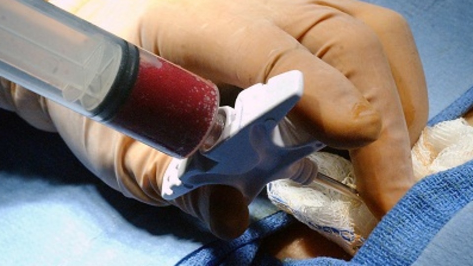 Akraba dışı ilik nakli yapılacak!