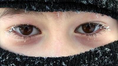 Soğuk yanıklarına dikkat!