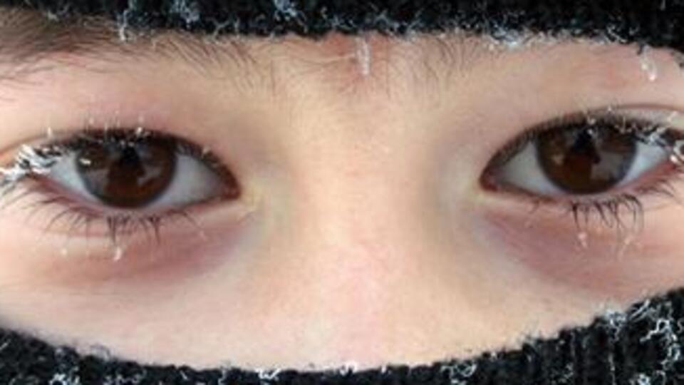 Soğuk yanıklarına dikkat!