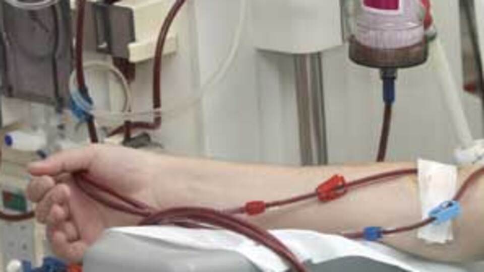 12 saat bir makineye bağlanıyorlar