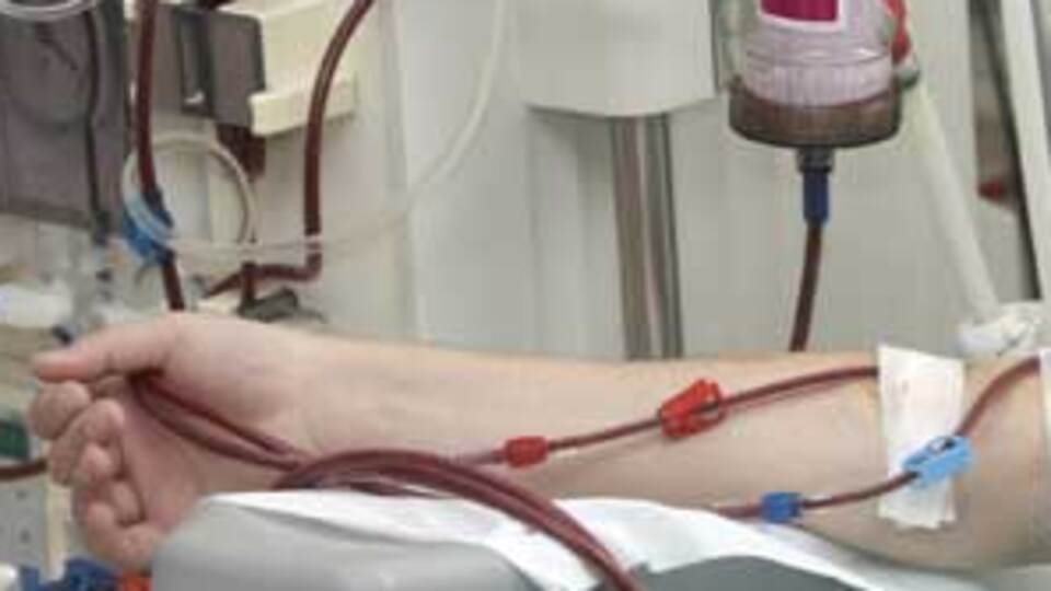 Diyaliz hastaları bunlardan uzak durmalı