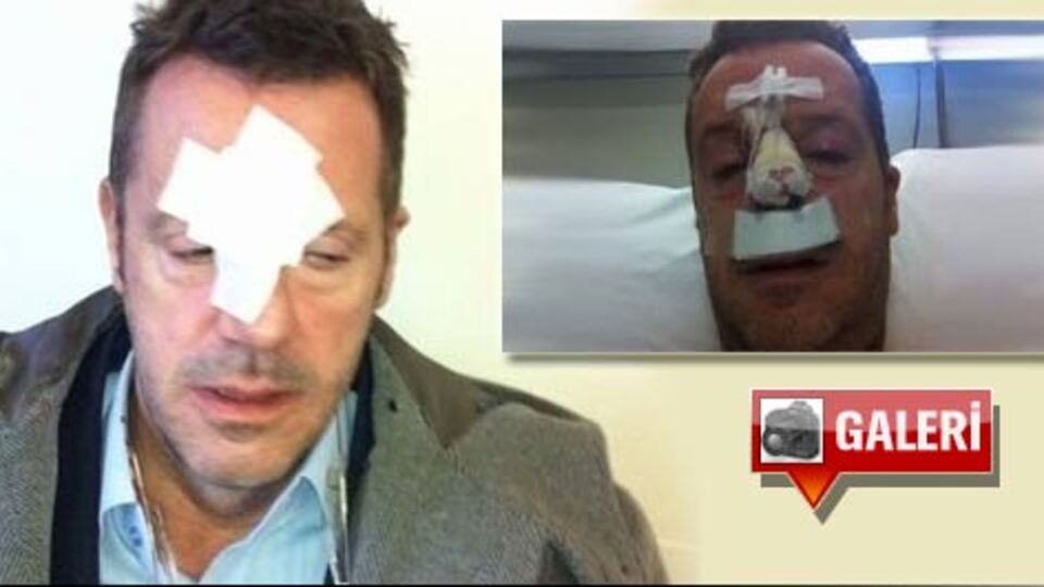 Can Tanrıyar saldırıya uğradı