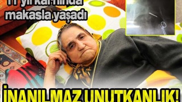 11 yıl karnında makasla yaşadı!