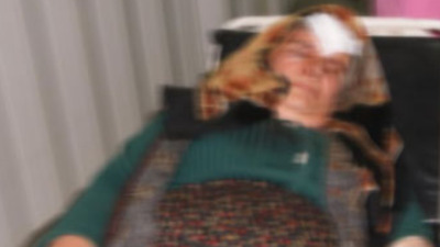 Kafasına güğümle vurdu