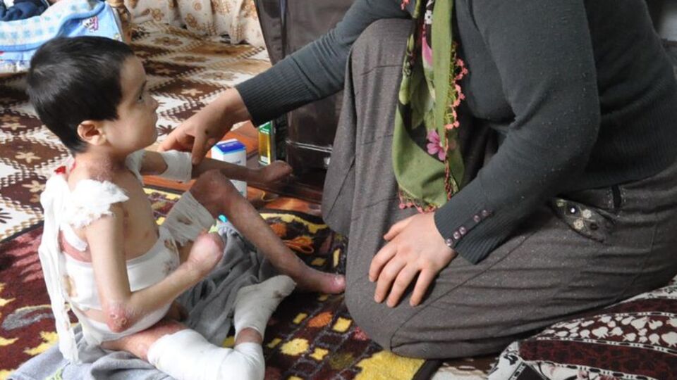 Canberk kardeşler mum gibi eriyor!