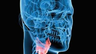 Bunama nedeni olabilir