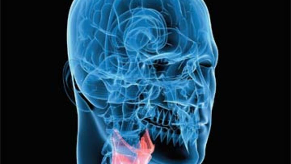 Bunama nedeni olabilir