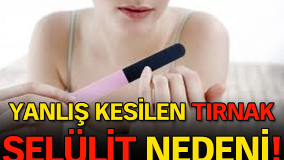 Yanlış kesilen tırnak selülit nedeni!