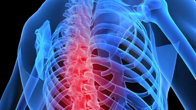 Kemik erimesinin 3 doğal ilacı!