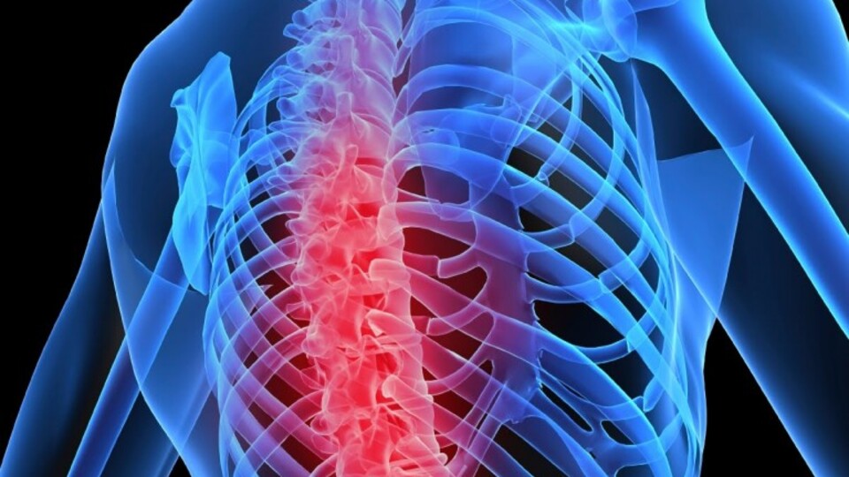 Kemik erimesinin 3 doğal ilacı!