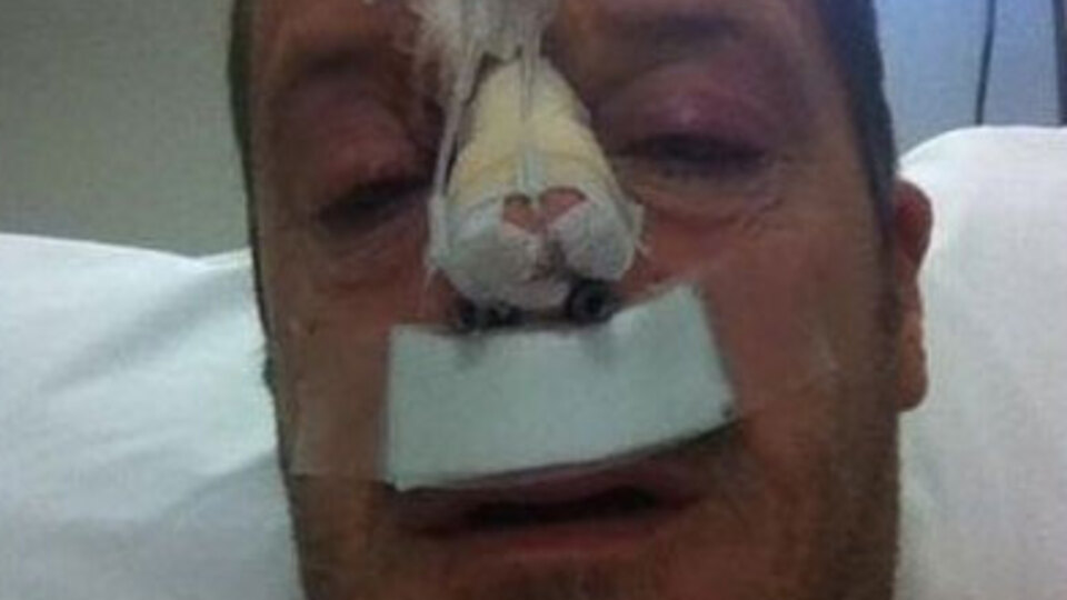 Tanrıyar'ın ve "kırık burnun" cezası belli oldu