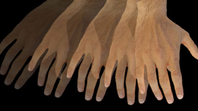 Türkiye'de parkinson alarmı!
