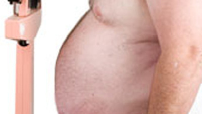 'Türkiye'de 13 milyon obez var'