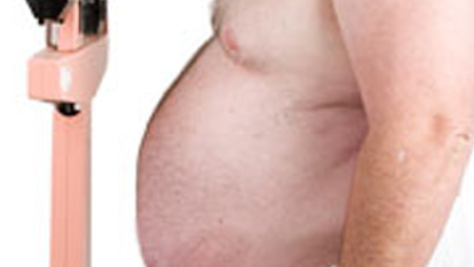 'Türkiye'de 13 milyon obez var'