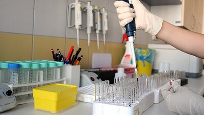 Sara nöbetlerine son verecek ilaç!