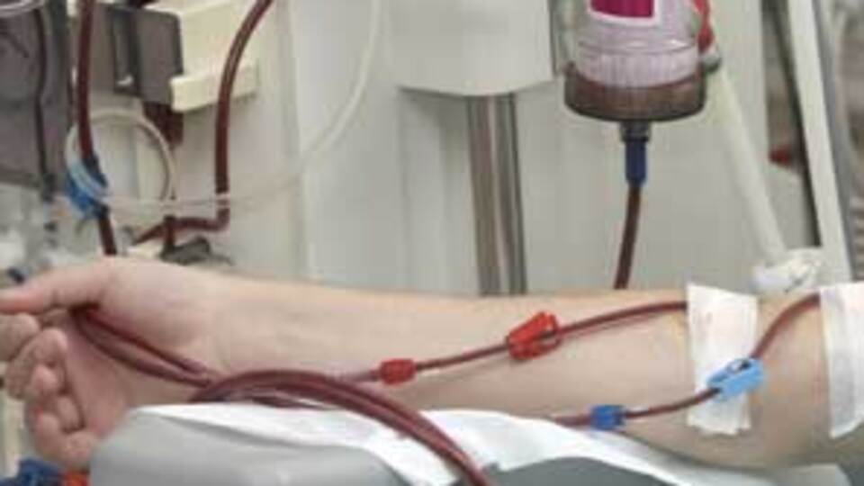 Diyaliz masrafları böbrek naklini geçiyor