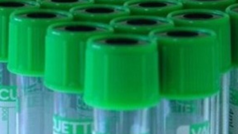 Ter testi ile erken tanı!