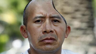 Kafatasının yarısı 58 milyon dolar