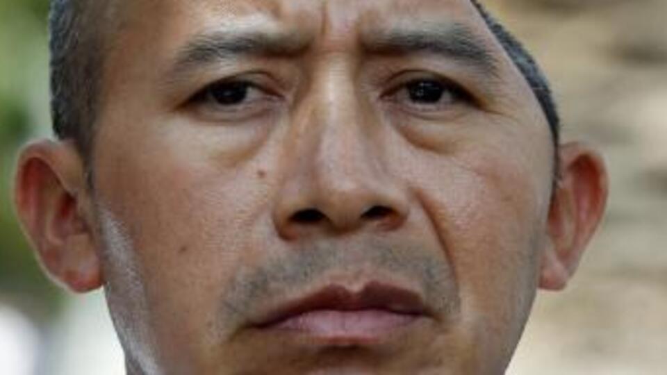 Kafatasının yarısı 58 milyon dolar