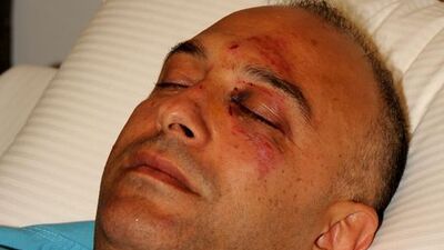 Adana'da doktora dayak