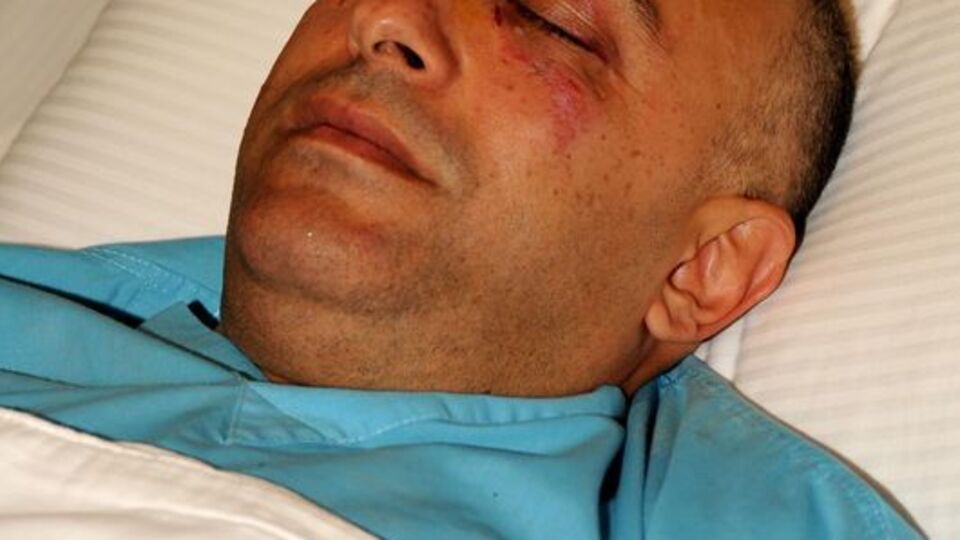 Adana'da doktora dayak