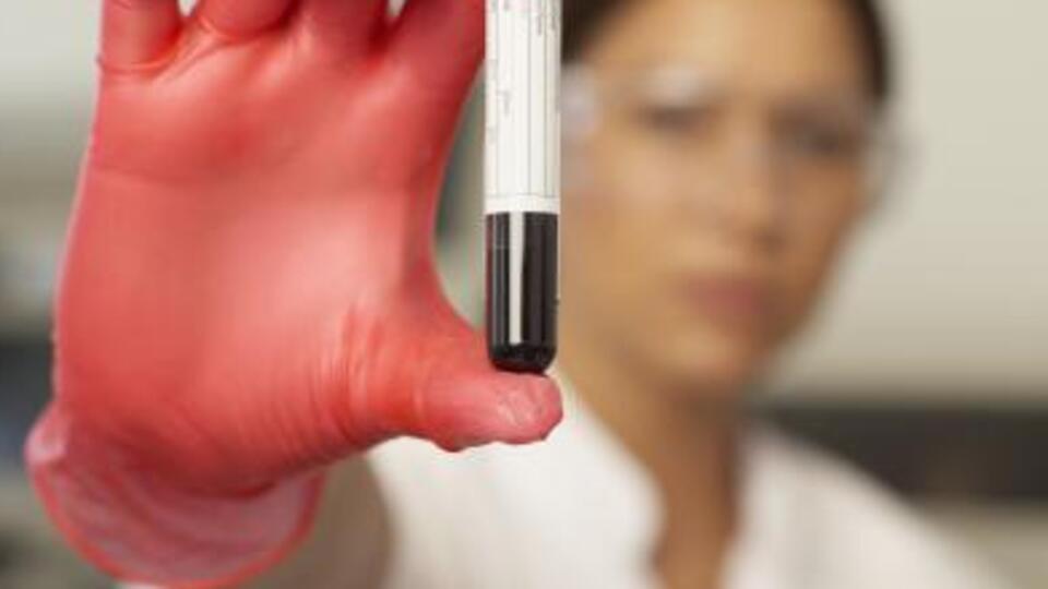 EÜ, Hemofili hastalarına umut olacak