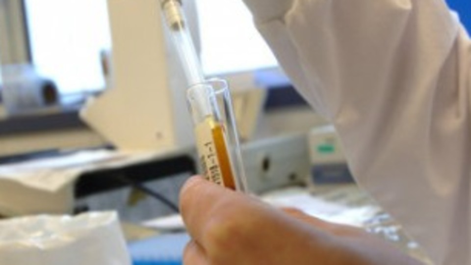 Kanser ve AIDS'e Türk ilacı