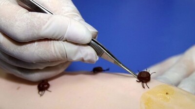 Piknik sezonu açıldı kene riski arttı