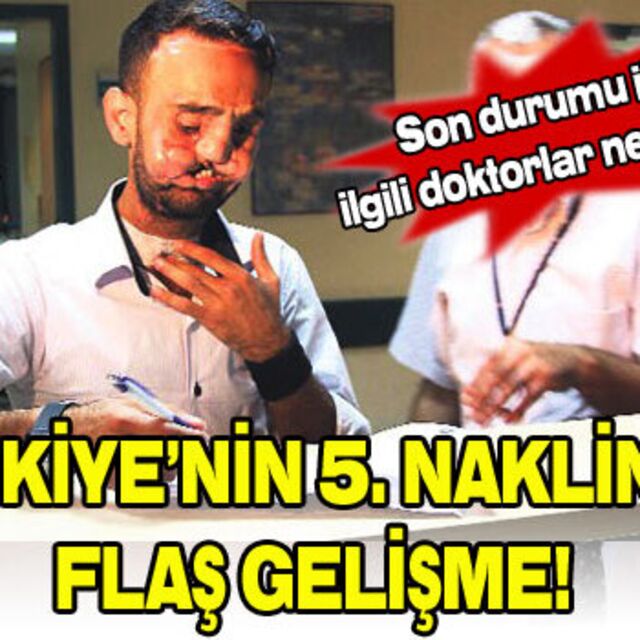 Recep Sert gözünü açtı