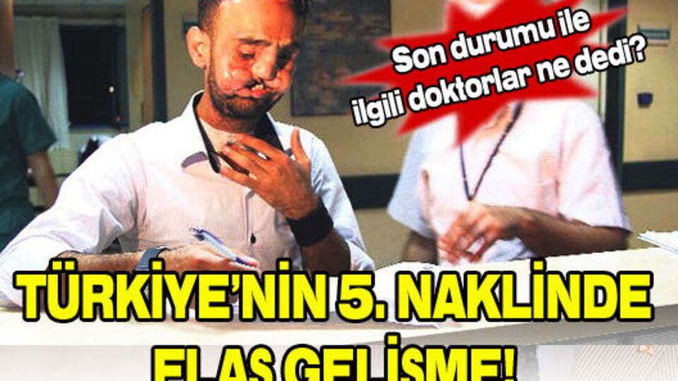 Recep Sert gözünü açtı