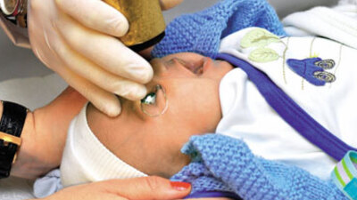 ROP hastalığı kör edebilir