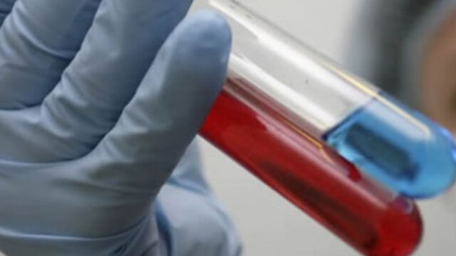 'HIV'den daha bulaşıcı'