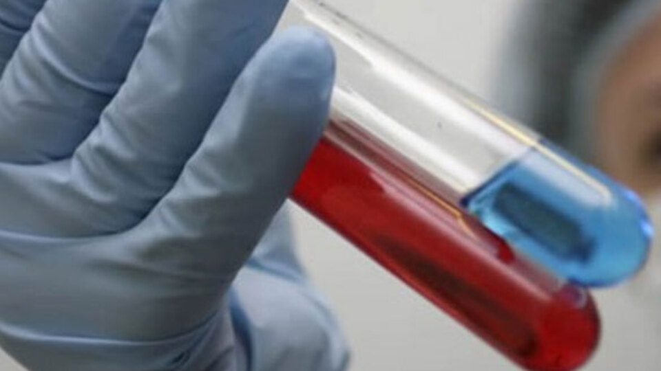 'HIV'den daha bulaşıcı'