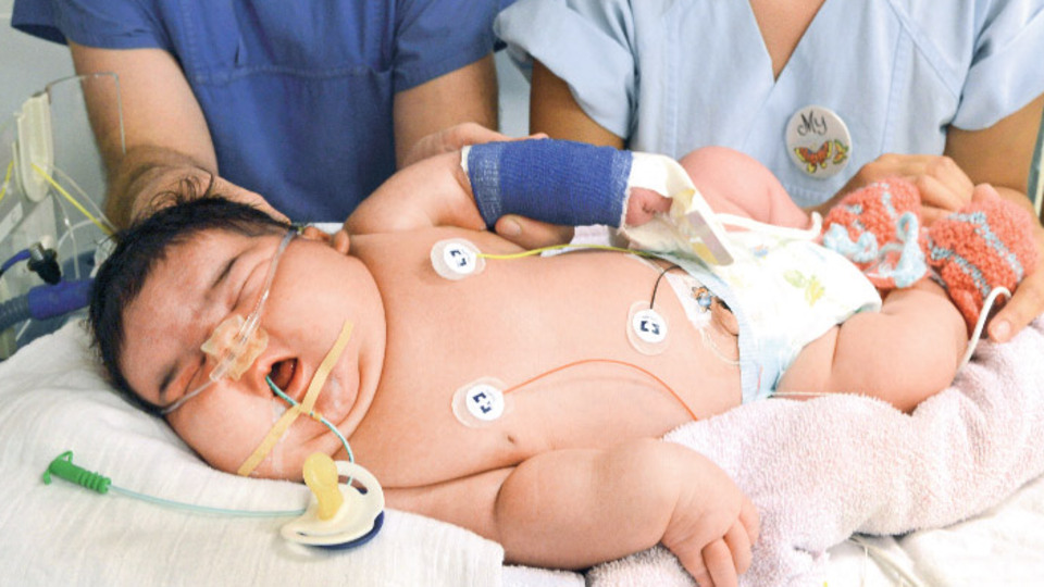 Herkesi şaşırtan bebek!