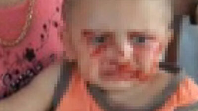 Uyuyunca kana bulanıyor