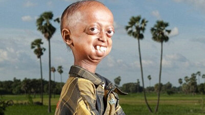 110 yaşında gibi görünen çocuk!