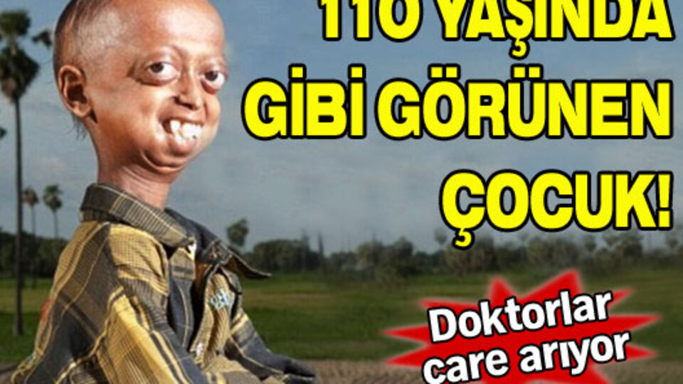 110 yaşında gibi görünen çocuk!