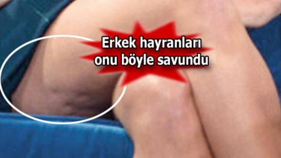 Selülitli ama seksi!