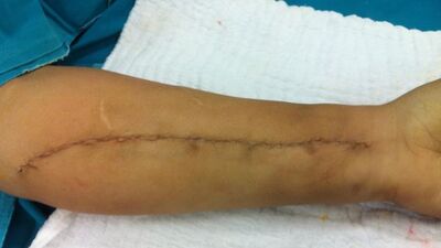 Kolundan çıkan görenleri dehşete düşürdü