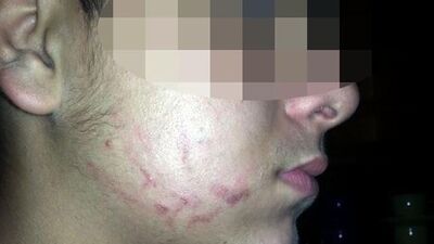 Yanağında beş parmağının izi kaldı