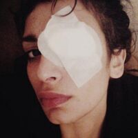 Kola elinde patladı!