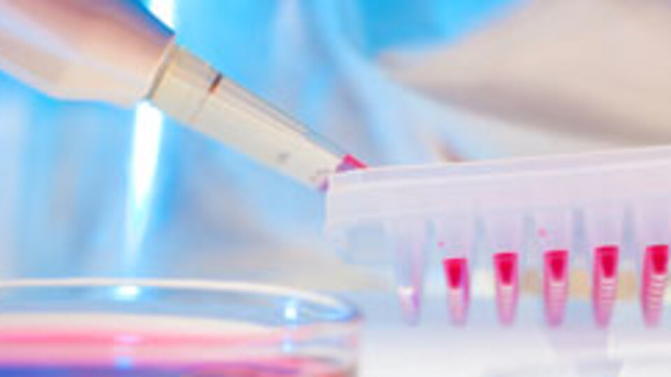 HIV hastalarında kalp riski!