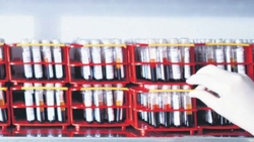 Yüzde 50 uyumlu ilikten nakil müjdesi