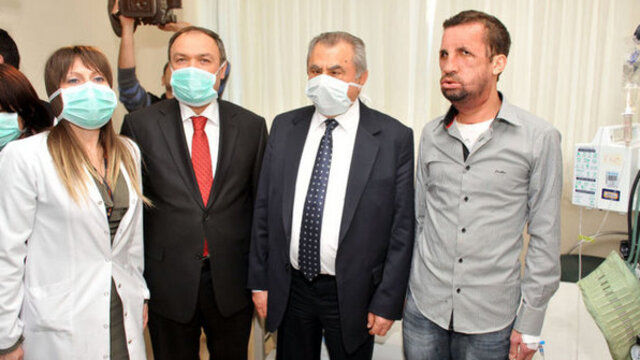 'Yüz nakli ihtiyaç için yapılıyor'