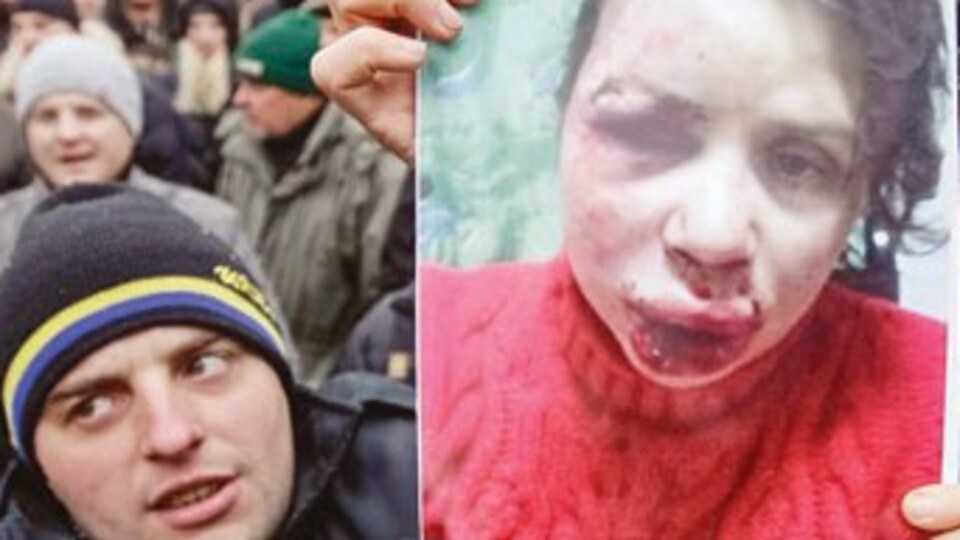 Gazeteciye yolsuzluk dayağı