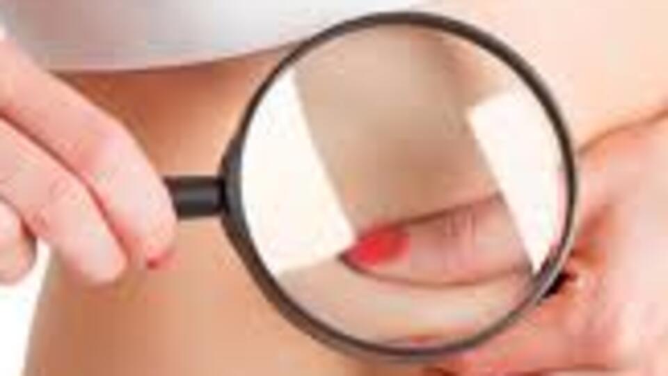 Cilt kanserinde yeni umut