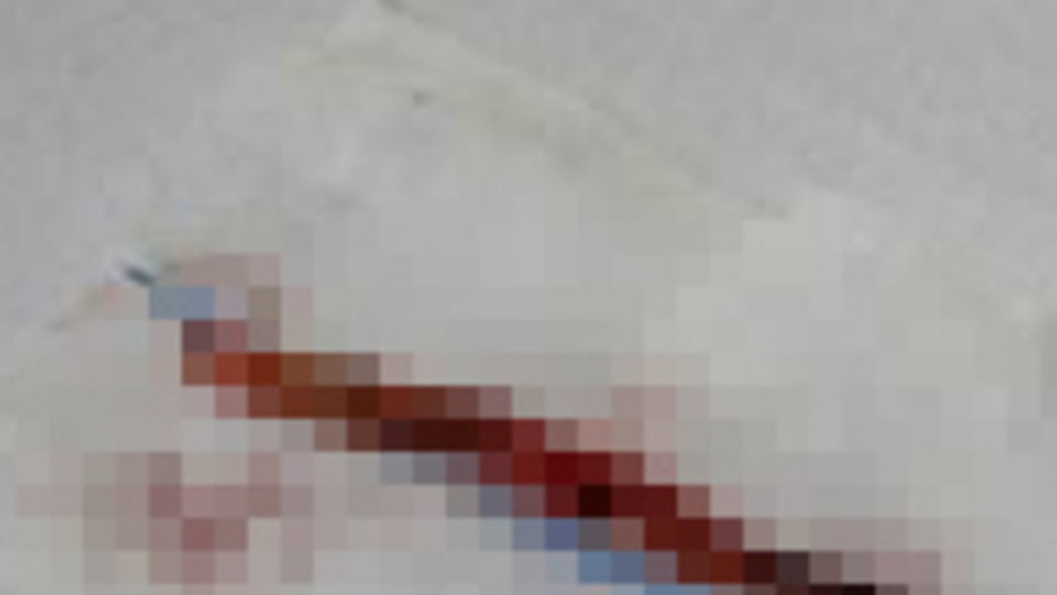 Damarından sigara çıktı!