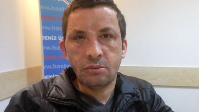 Uğur Acar'a botoks yapıldı