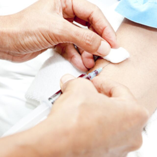 Türkiye'de 3,5 milyon Hepatit B'li var