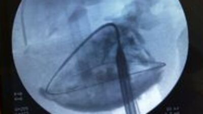 Bu ameliyat Türkiye'de bir ilk!